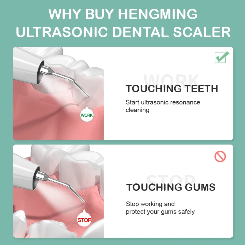 Xiaomi Youpin Smart Visual Sonic Стоматологический Скалер Для удаления зубного камня, пятен на зубах, средство для чистки зубов, набор инструментов для отбеливания зубов3
